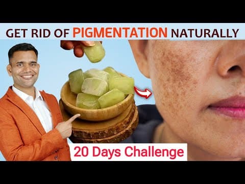 20 Days Challenge | Get Rid Of Pigmentation, Melasma Dark Spot Naturally thumbnail