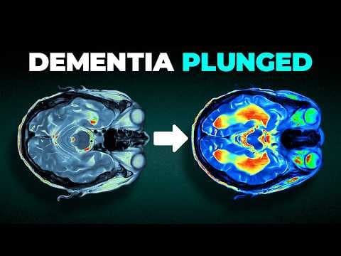 Dementia Rates PLUNGED in Study of 1,091,775 People thumbnail