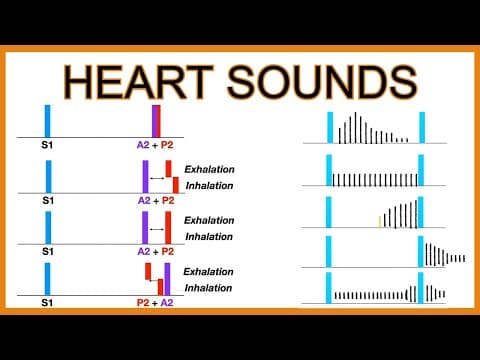 Heart Sounds (Murmurs and Splitting) thumbnail