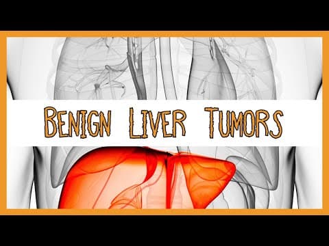 Benign Liver Tumors thumbnail