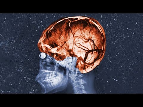 A Bitcoin Miner Heatstroked In His Sleep. This Is What Happened To His Organs. thumbnail