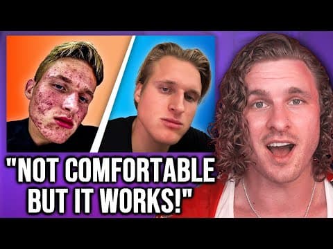 How I Cured My Acne Naturally (Only THIS Worked!) | REACTION thumbnail