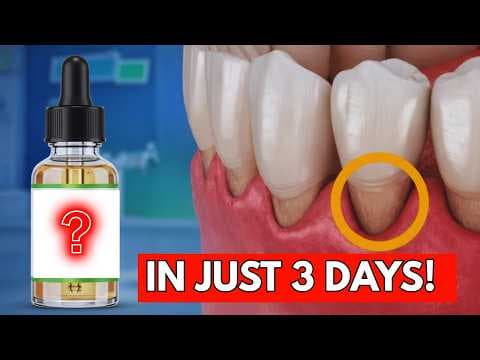 2 Drops Of This Oil  Regrow Receding Gums Fast thumbnail