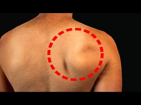 Why Your Shoulder Blade Wings (That EVERYONE Misses) thumbnail