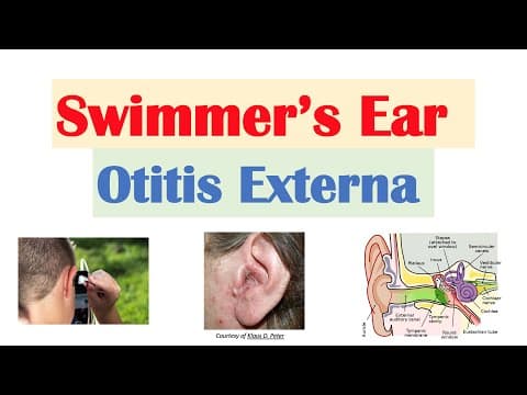 Swimmer’s Ear (Otitis Externa) | Risk Factors, Causes, Signs & Symptoms, Diagnosis, Treatment thumbnail