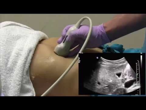 How I do it: Ultrasound of the Abdomen thumbnail