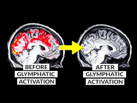 We Finally Know How To Detox The Brain Naturally thumbnail