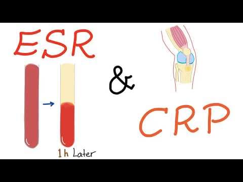 ESR and CRP thumbnail