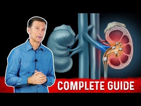Kidney Stones 101: Causes, Symptoms & Remedies – Dr.Berg thumbnail