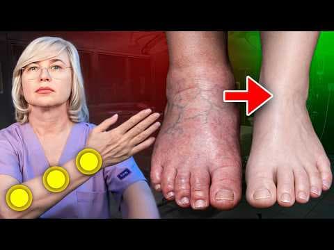 ПОКАЗЫВАЮ 3 ТОЧКИ НА РУКЕ, КОГДА ВЕНЫ ВЫПИРАЮТ И НОГИ ГУДЯТ thumbnail