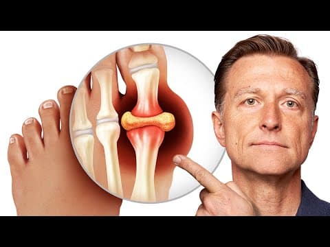 The Mystery of GOUT Revealed thumbnail
