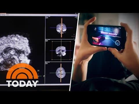 Ground-breaking look at the impact of screen time on kids' brains thumbnail