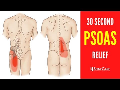 How to Quickly Relieve a Tight Psoas Muscle thumbnail