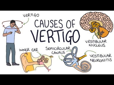 Understanding the Causes of Vertigo thumbnail