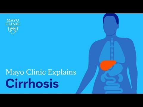 Mayo Clinic Explains Cirrhosis thumbnail