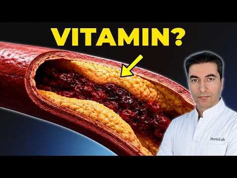 Najmoćniji VITAMINI za UKLANJANJE LOŠEG KOLESTEROLA IZ KRVNIH ŽILA! thumbnail