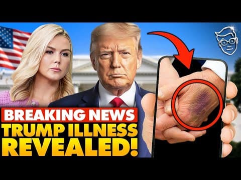 🚨White House Makes SHOCK Announcement on Trump’s Health After 'Bruising' Photos Go VIRAL: "Doctors.. thumbnail