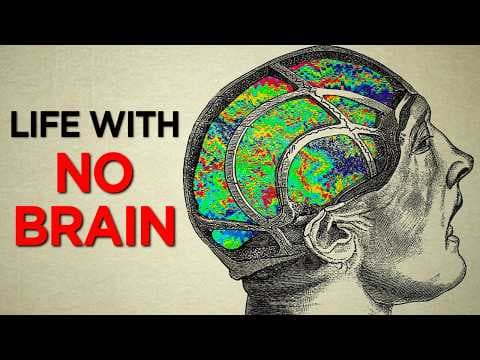The Man Who Lived with No Brain thumbnail