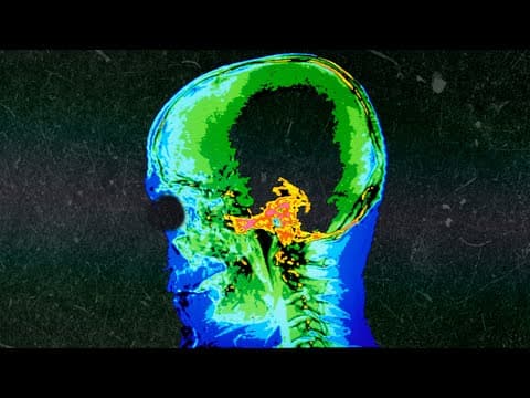 A Boy Ate 180 Gummy Melatonins For Lunch. This Is What Happened To His Brain. thumbnail