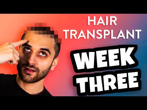 Hair Growth After Transplant 3(Weeks) Istanbul-Turkey_2020 thumbnail