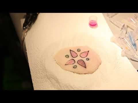 Tattoos as medical condition monitors thumbnail