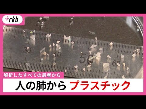 人の肺からプラスチック　「解析したすべての患者から検出された」　粒子濃度が高いほど炎症値も大きい結果　医師や研究者の解析で明らかに thumbnail