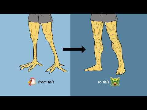 Fix your chicken legs with these 5 exercises thumbnail