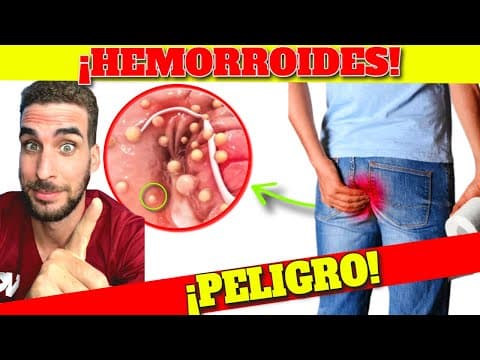 ¡FUE REVELADO! SÍNTOMAS de ALARMA de HEMORROIDES| CURAR HEMORROIDES de MANERA NATURAL thumbnail