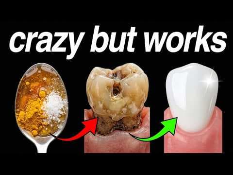 Stop Using Mouthwash — This Is What Your Gums Actually Need thumbnail