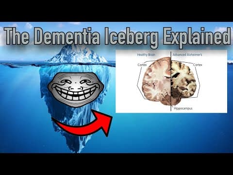 The Dementia Iceberg Explained thumbnail