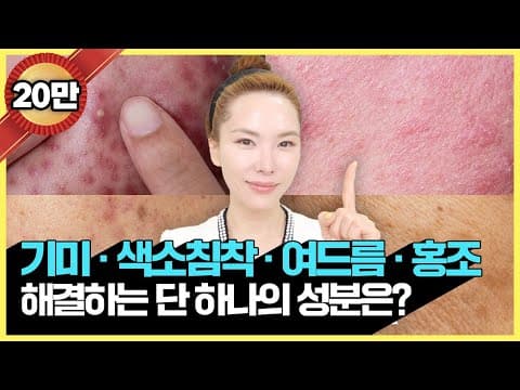 [64] 좋은 나이아신아마이드 화장품 고르는 2가지 방법❗️피부 고민에 따른 좋은 제품 추천 6종 추천 thumbnail