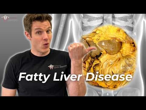 Is Your Liver in Danger? Understanding Fatty Liver Disease thumbnail