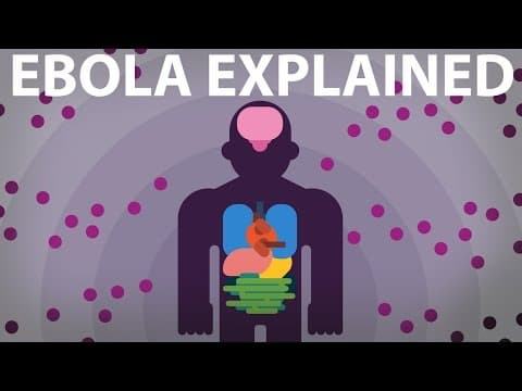 What Is the Ebola Virus and How Does It Affect the Body? thumbnail