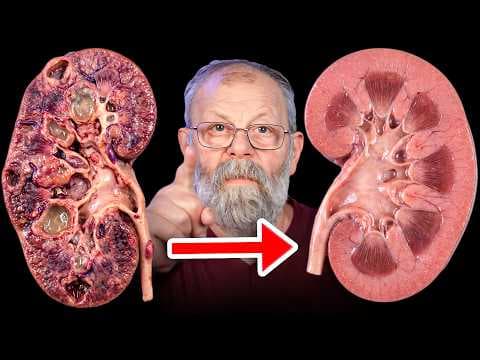 Почки мгновенно излечиваются пальцем! Просто повторите thumbnail