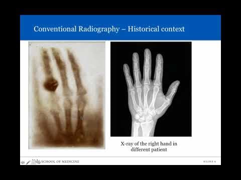 Introduction to Radiology: Conventional Radiography thumbnail