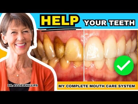 How To Create Healthy Teeth - My Complete Mouth Care System (Step-by-Step) thumbnail