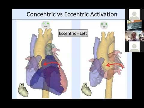 Miller 4 22 2020 Retrograde Conduction thumbnail