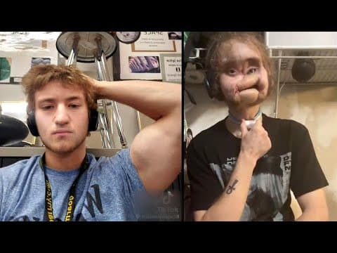 How Teen Survived Life-Changing Accident thumbnail