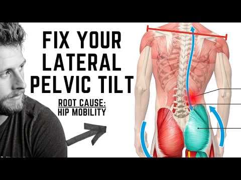 Struggling With Lateral Pelvic Tilt? Do THIS for Balance thumbnail