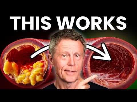 #1 Best Meal to Unclog Your Arteries thumbnail