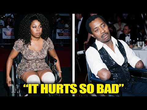 21 Black Celebrities Who Had Disabled Body Parts That You Didn't Know About thumbnail