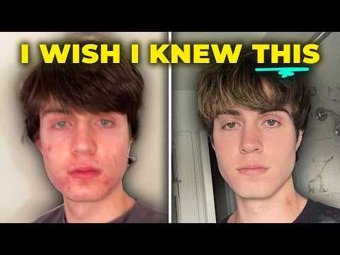 4 Years Of Looksmaxxing Advice In 18 Minutes (Full Guide) thumbnail
