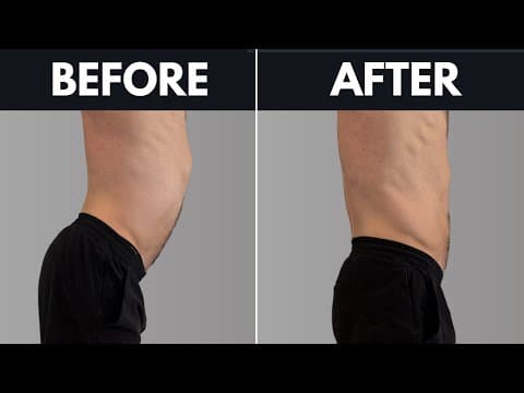 Fixing Anterior Pelvic Tilt is easy, actually. thumbnail