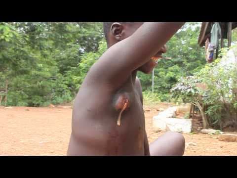 Improvising in Africa.  Warning - GROSS - Smarter Every Day 28 thumbnail