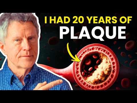 I Avoided a Heart Attack by Cleaning 20 Years of Clogged Arteries thumbnail