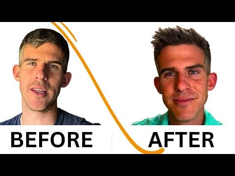 TMS Therapy Before and After - Jordan Bryant 31 thumbnail