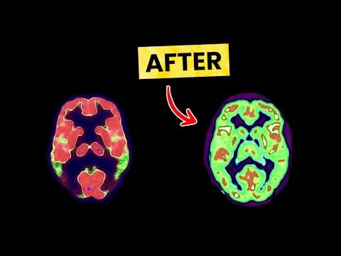 3 Instant ADHD Fixes More Powerful Than Medication thumbnail