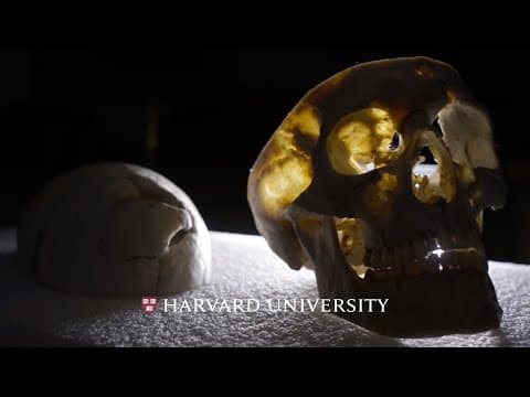 Lessons of the brain: the Phineas Gage case thumbnail