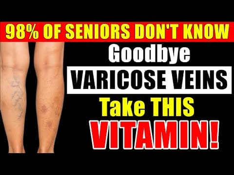 ✅ Seniors! “Over 60?: This VITAMIN DISSOLVE BLOOD CLOTS in Your LEGS!” thumbnail