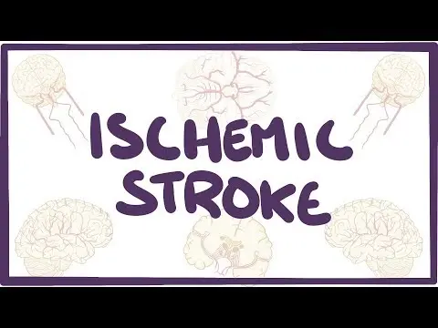 Ischemic Stroke - causes, symptoms, diagnosis, treatment, pathology thumbnail